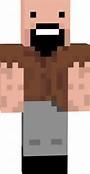 Who's skin is this?