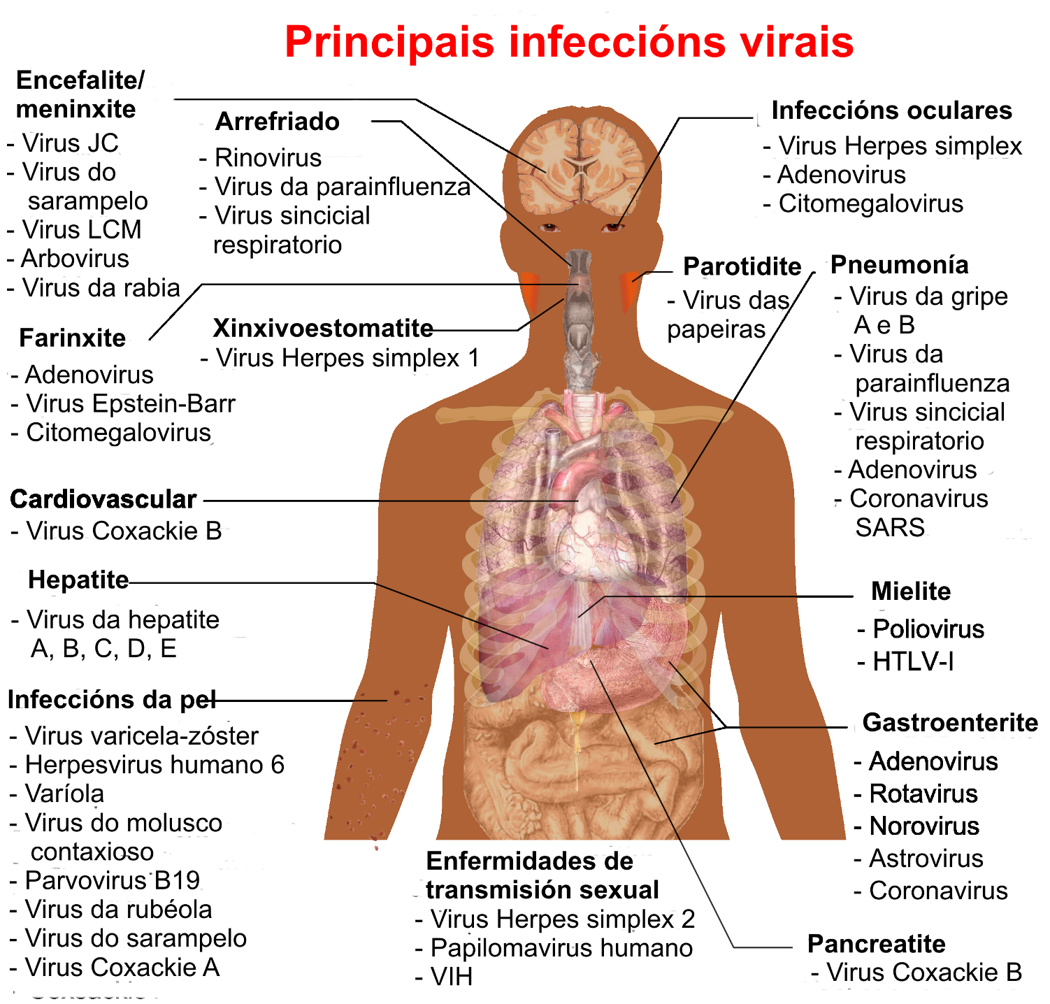 Which of the following is a viral disease?