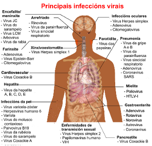 Which of the following is a viral disease?