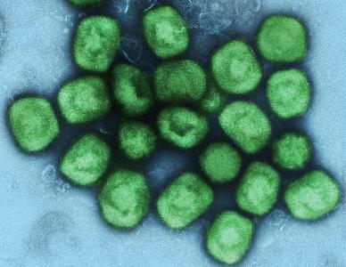 What type of microorganism is a virus?