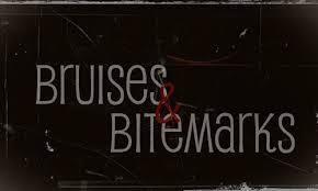 Bruises and Bitmarks