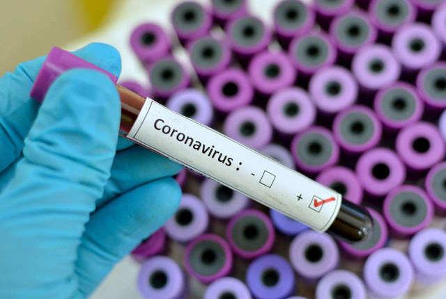 When and how do you think the Coronavirus pandemic will end?