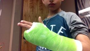 my brother broke his hand ;-;