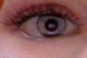 My Eye :)