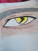 Lichen eye