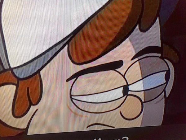 Dipper, what's wrong with your face?