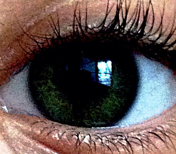 So I took a picture of my sister's eye...