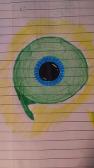 Septic Eye